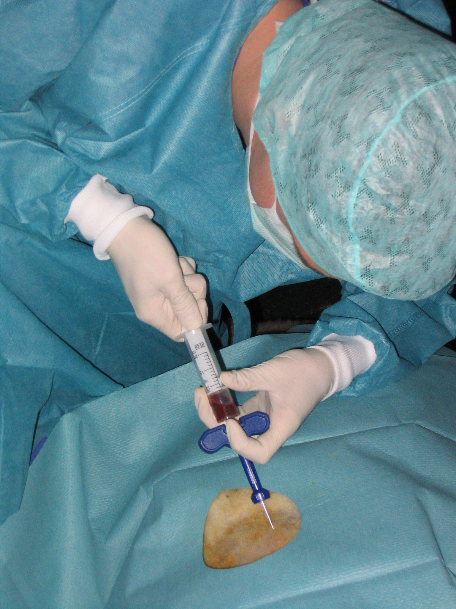 INTERVENTIONAL PAIN RELIEF